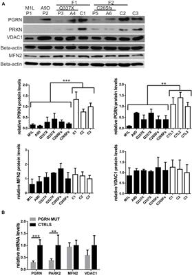 Parkin Levels Decrease in Fibroblasts With Progranulin (PGRN) Pathogenic Variants and in a Cellular Model of PGRN Deficiency